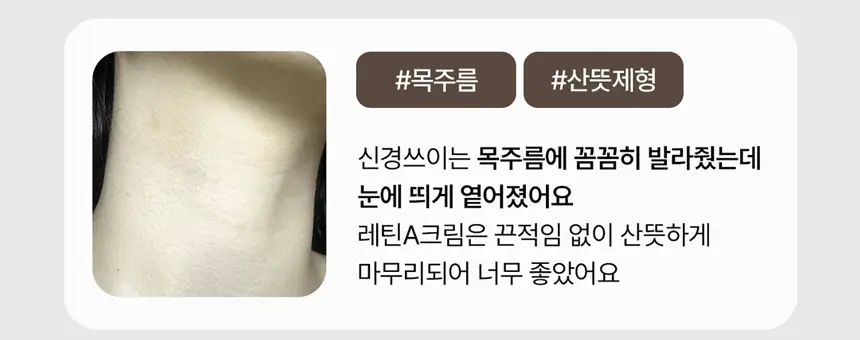 [모공탄력][단독기획] 테라로직 레틴에이 안티 링클 3D 크림 20g+마데셀 크림20ml 기획 상세페이지 3